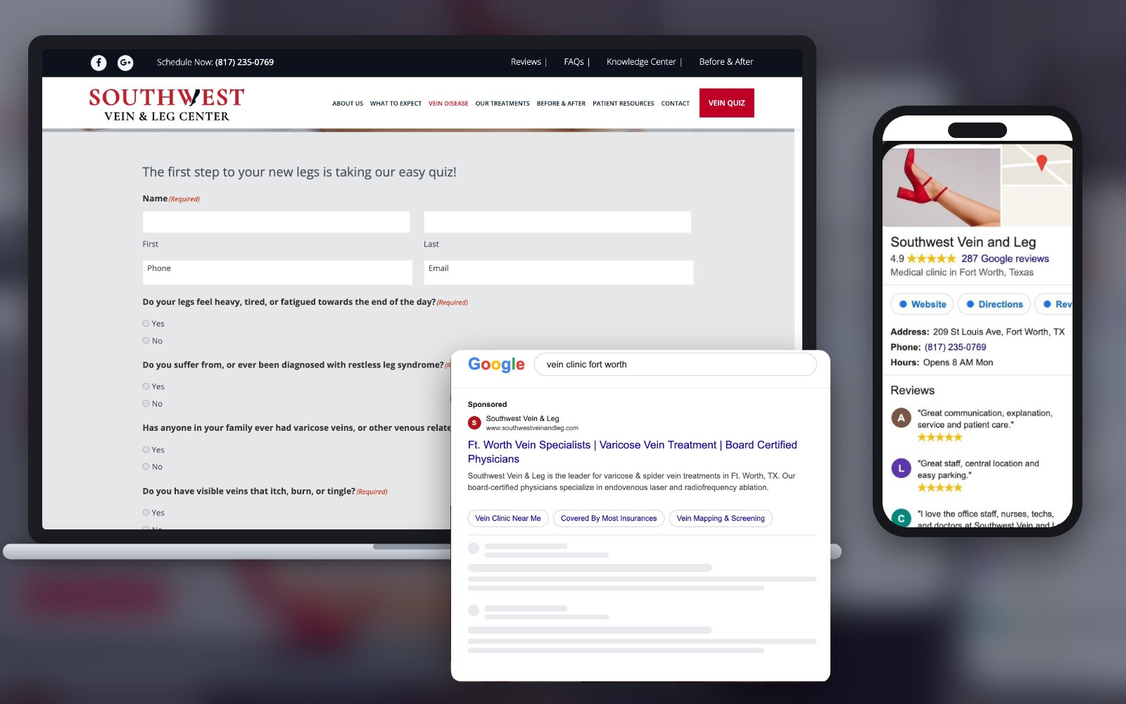 Southwest Vein & Leg vein quiz on laptop with Google search ad and Google Business Profile reviews