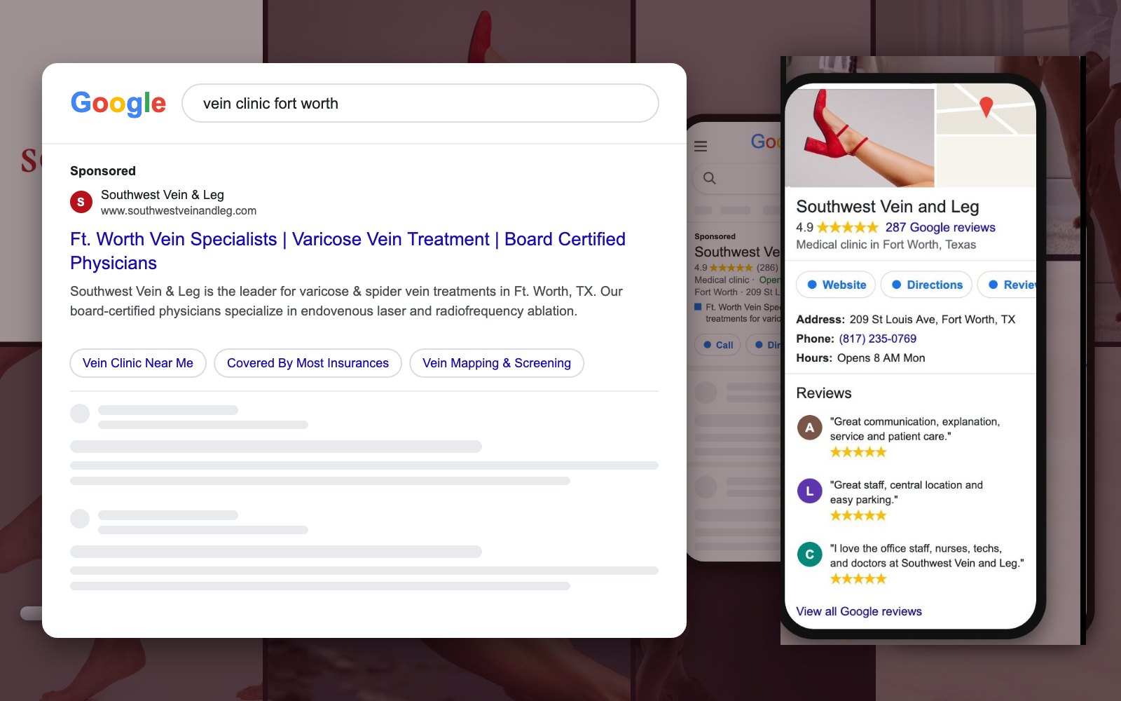 Southwest Vein & Leg Google search ad and Google Business Profile
